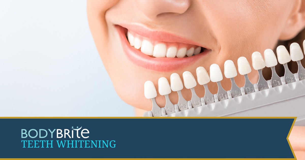 Teeth Whitening Service Austin TX BodyBrite Austin